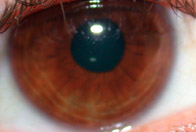 Vista detallada del iris de un ojo.