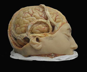 Modelo en cera de cerebro humano