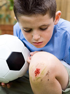 Un niño con un balón de fútbol, se mira la rodilla herida, con un rasponazo.