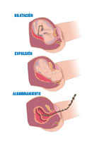 Ilustración con las tres fases del parto. Dilatación, expulsión y alumbramiento. Se ve una ilustración dividida en tres partes. En las tres imágenes se ve una sección de la matriz durante el parto. En la primera imagen de la dilatación se ve la colocación del bebé encogido y con la cabeza orientada hacía la salida del utero. En la segunda imagen se ve la cabeza del bebé en el momento de la expulsión. La tercera imagen es la misma sección del útero pero viendo los restos de la placenta y el cordón una vez que ha nacido el bebé.