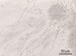  Imagen de microscopio óptico donde se aprecian diferentes estados del hongo Candida albicans.