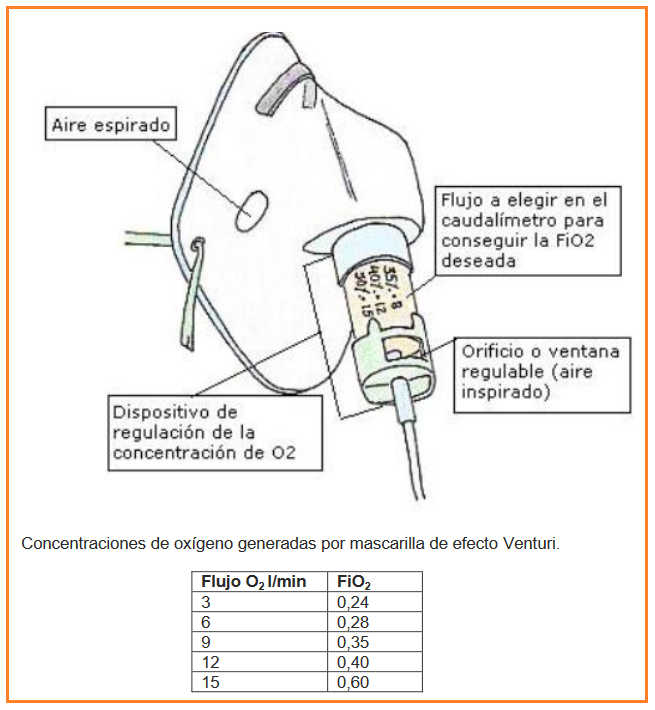 El efecto Venturi y su aplicación en Oxigenoterapia a alto flujo