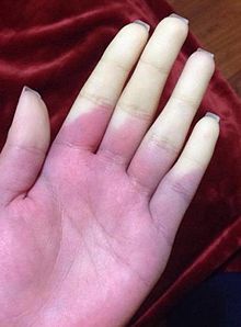 S.RAYNAUD