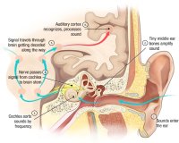 Corte sagital de la mitad izquierda de la cabeza que muestra la anatomía del sistema auditivo y el recorrido de la energía sonora desde el aire, pasando por la cóclea y desde aquí la energía eléctrica transportada por los nervios hasta la corteza auditiva.