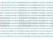 Electroencefalograma.