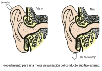 Visualización del conducto auditivo externo