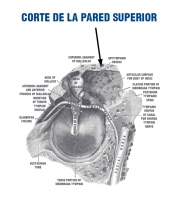 Descripción de la imagen