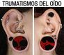 Imagen de pendientes y anillos