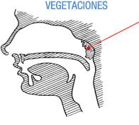 Imagen de la ubicación de las vegetaciones