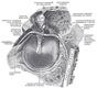 Imagen de la localización colesteatoma