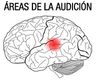 Imagen del cerebro marcando el área de audición