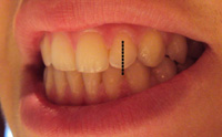 Posición dental de una boca en oclusión.