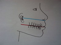 Planos de Camper y oclusal, siendo ambos prácticamente paralelos.