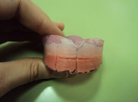 Rodete superior con la marca en rotulador negro de la línea incisal.
