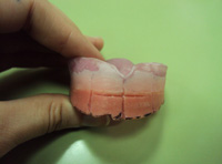 Rodete superior con las marcas para determinar los dientes que se van a colocar.