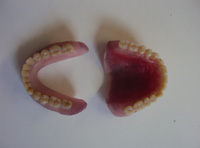 Prótesis completas superior e inferior en cera para la prueba de dientes.