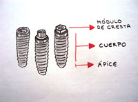 Esquema representativo con las partes de un implante.