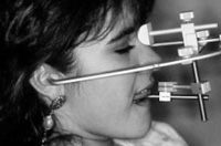 Paciente con el arco facial colocado y mordiendo la horquilla.