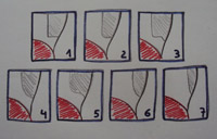 Esquema representativo de diferentes tipos de tallados dentales.