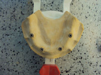 Modelo de yeso con cuatro réplicas de implantes.