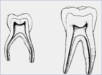 Imagen que muestra las diferencias anatómicas entre molares temporales y permanentes.