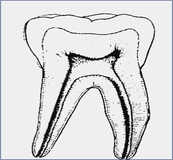 Imagen que muestra la anatomía de un molar permanente.