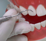 Imagen que muestra como realizar correctamente el fulcro intraoral.