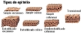 Diagramas que muestran los diferentes tipos de epitelio de revestimiento de acuerdo al tipo de células y los estratos que los forman.