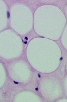 Imagen al microscopio de los adipocitos.