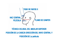 Dibujo en el que se observa la posición de la cabeza, la dirección del rayo central y la posición de la película en la técnica oclusal del maxilar superior.