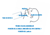 Dibujo en el que se observa la posición de la cabeza, la dirección del rayo central y la posición de la película en la técnica oclusal mandibular.