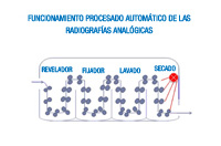 Esquema del funcionamiento de la procesadora de revelado automático. Se observa el sistema de exprimidor de los rodetes pasando por los distintos recipientes.