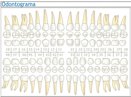 Odontograma con una presentación de tres caras dentales.