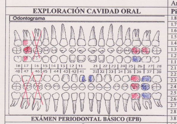 Nombre:ESO03_TAREA_R01odontogramaresuelto1.jpg