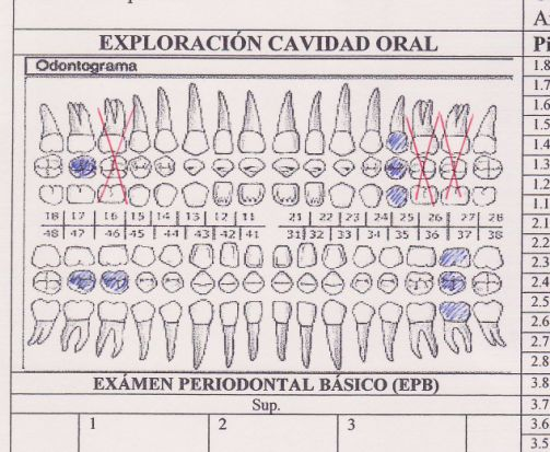 ESO03_TAREA_R02_odontogramaresuelto2.jpg