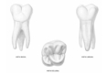 1er M superior vistasvestibular, lingual y oclusal.