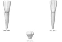 Superficies vestibular, lingual y oclusal del IC inferior.