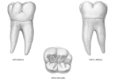 1er M inferior vistas vestibular, lingual y oclusal.