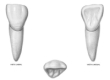 Superficies vestibular, lingual y oclusal del IC.