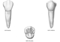 1er PM superior vistas vestibular, lingual y oclusal.