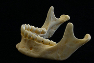 Visión lateral del maxilar inferior.