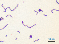 Imagen al microscopio del Streptococus Mutans.