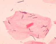 Imagen al microscopio del Lactobacillus.