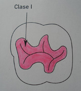 Imagen que ilustra la clase 1 de Black.