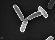 Imagen de Salmonella typhimurium. 