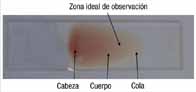 Se muestra una extensión de sangre obre portabjetos en la que se señalan las tres zonas: Cabeza, cuerpo y cola.