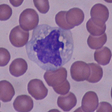 Monocito. Se observan varios hematíes y un monocito que es una célula de mayor tamaño y núcleo de color azul.