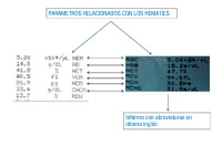 Imagen donde se observan los resultados de dos contadores diferentes, de modo que se pueden comparar la nomenclatura que utilizan ambos. Se han dispuesto líneas horizontales que facilitan la relación entre parámetros similares.