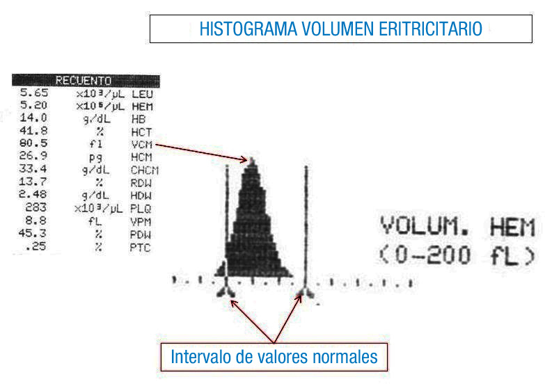 Imagen donde aparece el histograma de distribución del volumen eritrocitario relacionado con su dato numérico. También se han resaltado las barras verticales que delimitan el intervalo de normalidad.