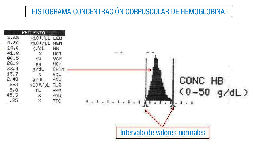 Imagen donde aparece el histograma de distribución de la concentración de hemoglobina corpuscular media relacionada con su dato numérico. También se han resaltado las barras verticales que delimitan el intervalo de normalidad.